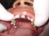 dental_chomka_chek_00024